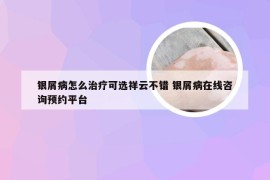 银屑病怎么治疗可选祥云不错 银屑病在线咨询预约平台