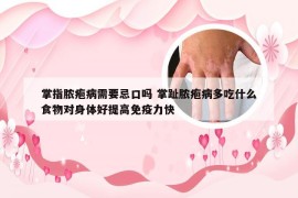 掌指脓疱病需要忌口吗 掌趾脓疱病多吃什么食物对身体好提高免疫力快