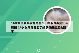 14岁的小女孩后背局部长一些小白点是什么原因 14岁女孩后背起了好多疙瘩是怎么回事