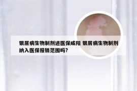 银屑病生物制剂进医保咸阳 银屑病生物制剂纳入医保报销范围吗?