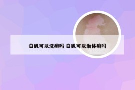 白矾可以洗癣吗 白矾可以治体癣吗