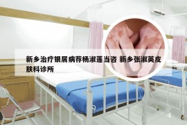 新乡治疗银屑病荐杨淑莲当咨 新乡张淑英皮肤科诊所