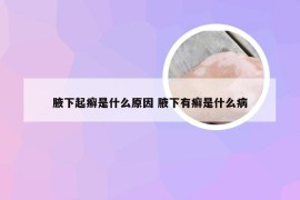 腋下起癣是什么原因 腋下有癣是什么病