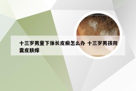 十三岁男童下体长皮癣怎么办 十三岁男孩阴囊皮肤痒