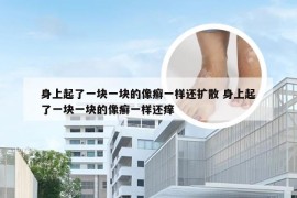 身上起了一块一块的像癣一样还扩散 身上起了一块一块的像癣一样还痒