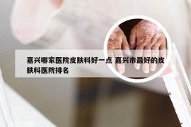 嘉兴哪家医院皮肤科好一点 嘉兴市最好的皮肤科医院排名