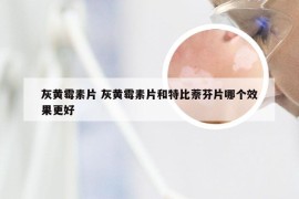 灰黄霉素片 灰黄霉素片和特比萘芬片哪个效果更好