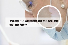 皮肤痒是什么原因造成的应该怎么解决 皮肤痒的原因和治疗