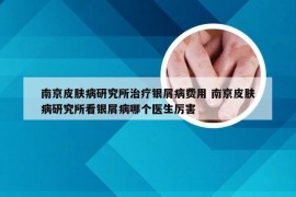 南京皮肤病研究所治疗银屑病费用 南京皮肤病研究所看银屑病哪个医生厉害