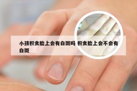 小孩积食脸上会有白斑吗 积食脸上会不会有白斑