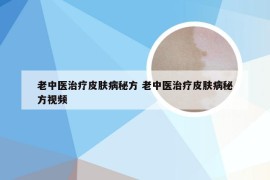 老中医治疗皮肤病秘方 老中医治疗皮肤病秘方视频