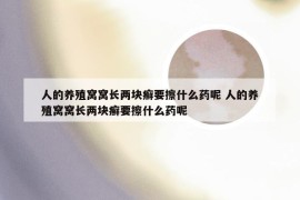 人的养殖窝窝长两块癣要擦什么药呢 人的养殖窝窝长两块癣要擦什么药呢