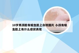10岁男孩脸有蛔虫脸上白斑图片 小孩有蛔虫脸上有什么症状表现
