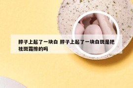 脖子上起了一块白 脖子上起了一块白斑是把祛斑霜擦的吗