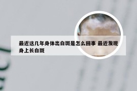 最近这几年身体出白斑是怎么回事 最近发现身上长白斑