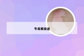 牛皮癣自述