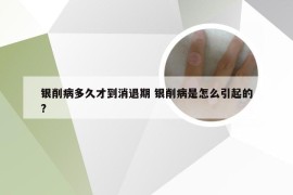 银削病多久才到消退期 银削病是怎么引起的?