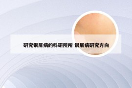研究银屑病的科研院所 银屑病研究方向