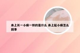 身上长一小癣一样的是什么 身上起小癣怎么回事