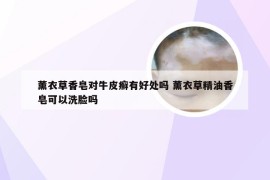薰衣草香皂对牛皮癣有好处吗 薰衣草精油香皂可以洗脸吗