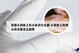 百度小孩身上长小白点什么病 小孩身上出现小白点是怎么回事