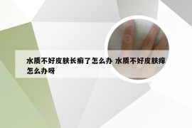水质不好皮肤长癣了怎么办 水质不好皮肤痒怎么办呀
