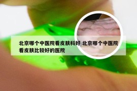 北京哪个中医院看皮肤科好 北京哪个中医院看皮肤比较好的医院