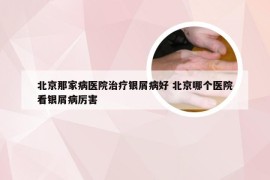 北京那家病医院治疗银屑病好 北京哪个医院看银屑病厉害