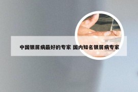 中国银屑病最好的专家 国内知名银屑病专家