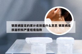 银屑病鉴定的累计皮损是什么意思 银屑病皮损面积和严重程度指数