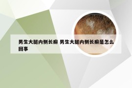 男生大腿内侧长癣 男生大腿内侧长癣是怎么回事