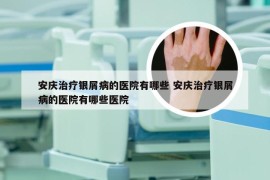 安庆治疗银屑病的医院有哪些 安庆治疗银屑病的医院有哪些医院