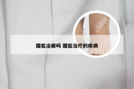 醋能冶廨吗 醋能治疗的疾病