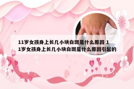 11岁女孩身上长几小块白斑是什么原因 11岁女孩身上长几小块白斑是什么原因引起的