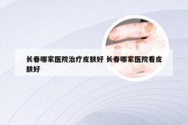 长春哪家医院治疗皮肤好 长春哪家医院看皮肤好