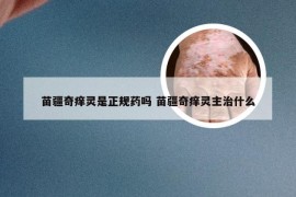 苗疆奇痒灵是正规药吗 苗疆奇痒灵主治什么