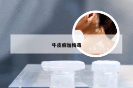 牛皮癣加梅毒
