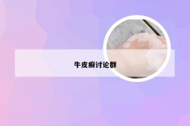 牛皮癣讨论群