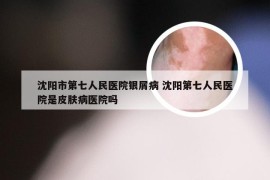 沈阳市第七人民医院银屑病 沈阳第七人民医院是皮肤病医院吗