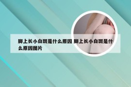 脚上长小白斑是什么原因 脚上长小白斑是什么原因图片