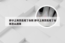 脖子上突然出现了白斑 脖子上突然出现了白斑怎么回事