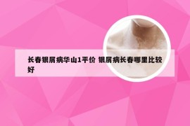 长春银屑病华山1平价 银屑病长春哪里比较好