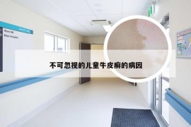 不可忽视的儿童牛皮癣的病因
