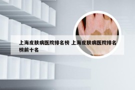 上海皮肤病医院排名榜 上海皮肤病医院排名榜前十名