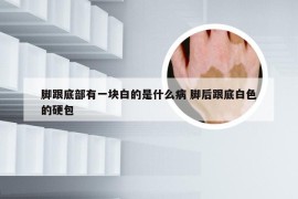 脚跟底部有一块白的是什么病 脚后跟底白色的硬包