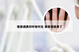 银屑病黑印时有时无 银屑病变黑了