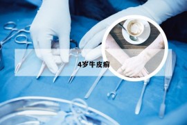 4岁牛皮癣