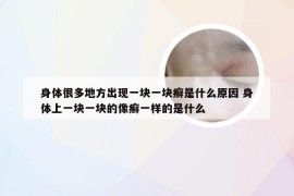 身体很多地方出现一块一块癣是什么原因 身体上一块一块的像癣一样的是什么