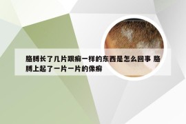 胳膊长了几片跟癣一样的东西是怎么回事 胳膊上起了一片一片的像癣