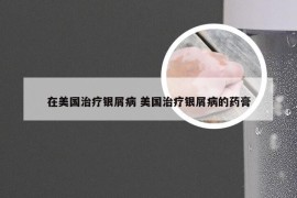 在美国治疗银屑病 美国治疗银屑病的药膏